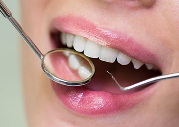 علاج عصب الاسنان